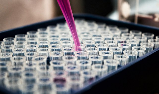 Stem Cells and Disease Modeling