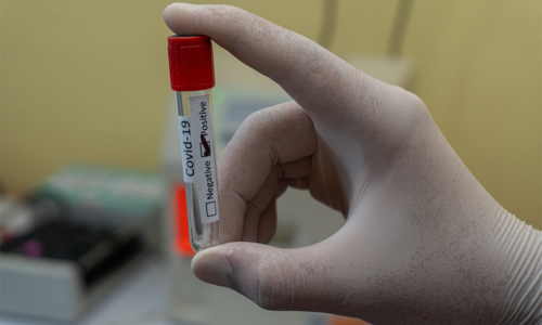 University of Oxford-Public health and biomedicine:  Coronavirus “fighting epidemic”